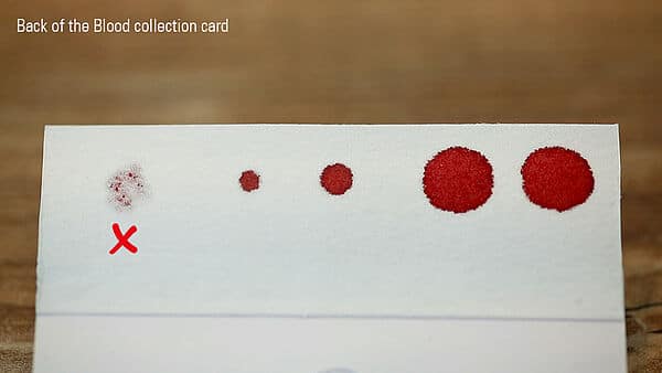 Blood Collection 1