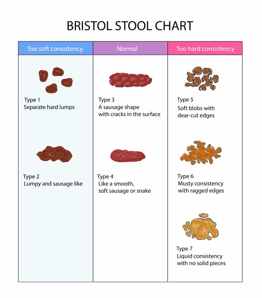 When is a bowel movement considered healthy? | Homed-IQ