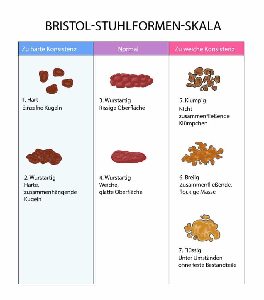 When is a bowel movement considered healthy? - Homed-IQ