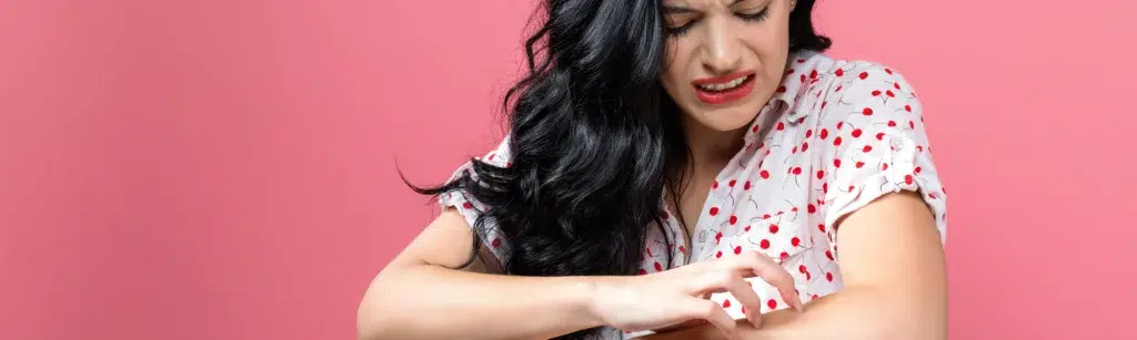 Gilt Krätze als sexuell übertragbare Infektion?